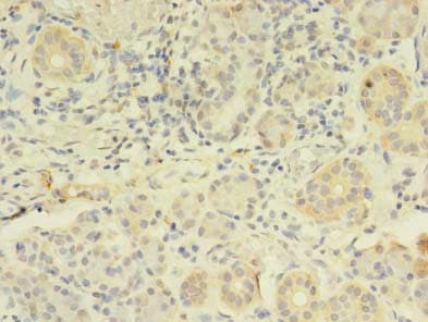 Polyclonal Rabbit anti-Human FKBP11 Antibody (IHC, WB)