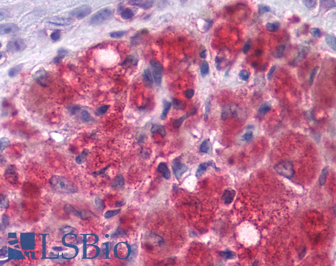PathPlus™ GRM3 / MGLUR3 Antibody (N-Terminus)
