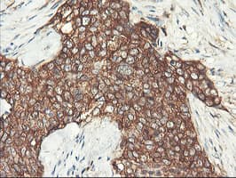PFKP Antibody (clone OTI1F2)