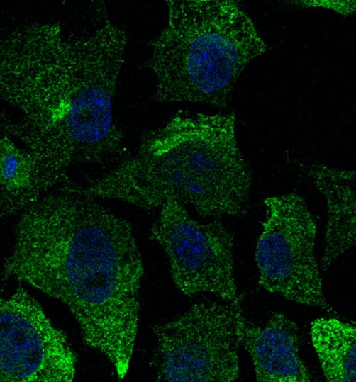 IHC-plus™ CAV1 / Caveolin 1 Antibody (N-Terminus)