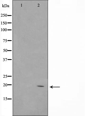 ASH2L / ASH2 Antibody