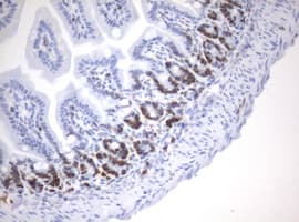MKI67 / Ki67 Antibody (aa1160-1493, clone OTI8B11)