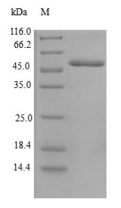 Human CENPH / CENP-H Protein (Recombinant GST, N-terminus)