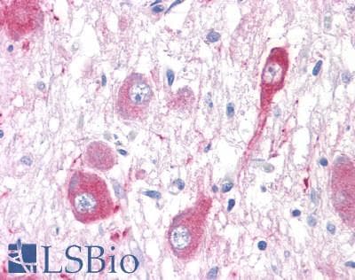 PathPlus™ GRM5 / MGLUR5 Antibody (C-Terminus)