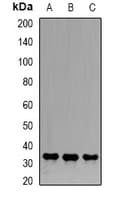 EMD / Emerin Antibody