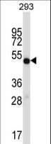 IHC-plus™ IMPDH1 Antibody (aa487-514)