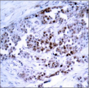 Polyclonal Rabbit anti-Human BCL2 / Bcl-2 Antibody (IHC)