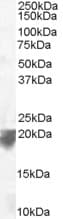 Polyclonal Goat anti-Human VPS29 Antibody (aa174-186, WB)