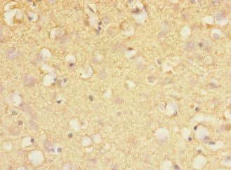 Polyclonal Rabbit anti-Human MARK1 / MARK Antibody (IHC, WB)