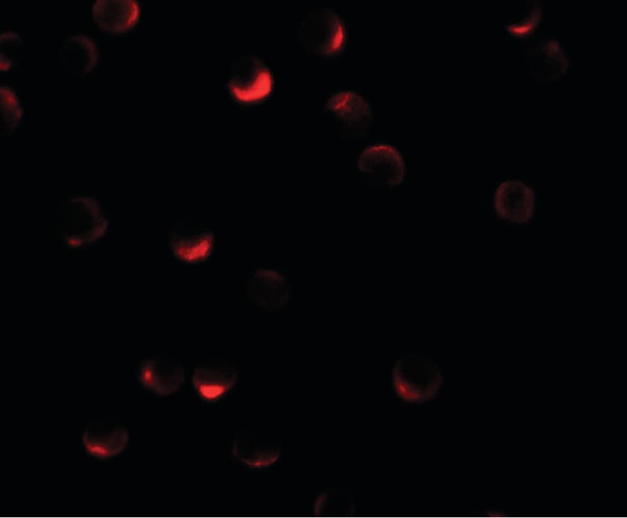 IHC-plus™ Polyclonal Rabbit anti-Human RILP Antibody (IHC, IF, WB)