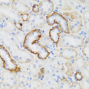 NEFH / NF-H Antibody