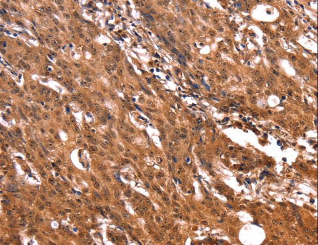 ERN2 Antibody