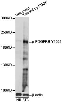 Polyclonal Rabbit anti-Human PDGFRB / PDGFR Beta Antibody (phospho-Tyr1021, WB)