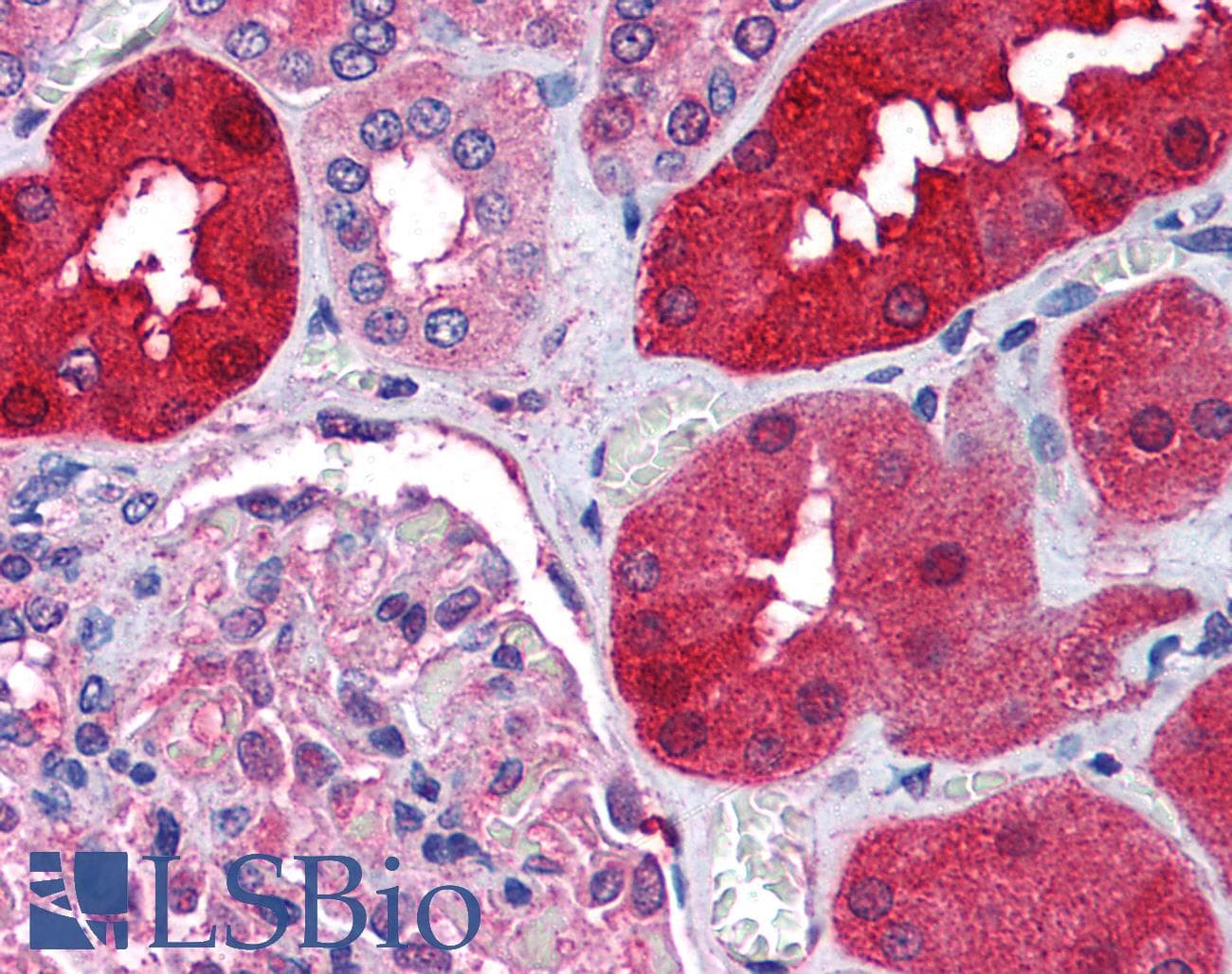 IHC-plus™ Polyclonal Goat anti-Human RNF213 Antibody (aa5191-5204, IHC)