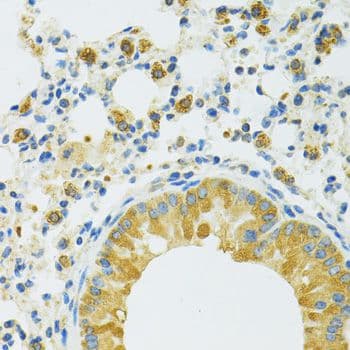 SLC37A4 / G6PT Antibody