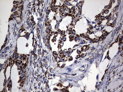 PIK3CD / PI3K Delta Antibody (aa286-610, clone OTI6A12)
