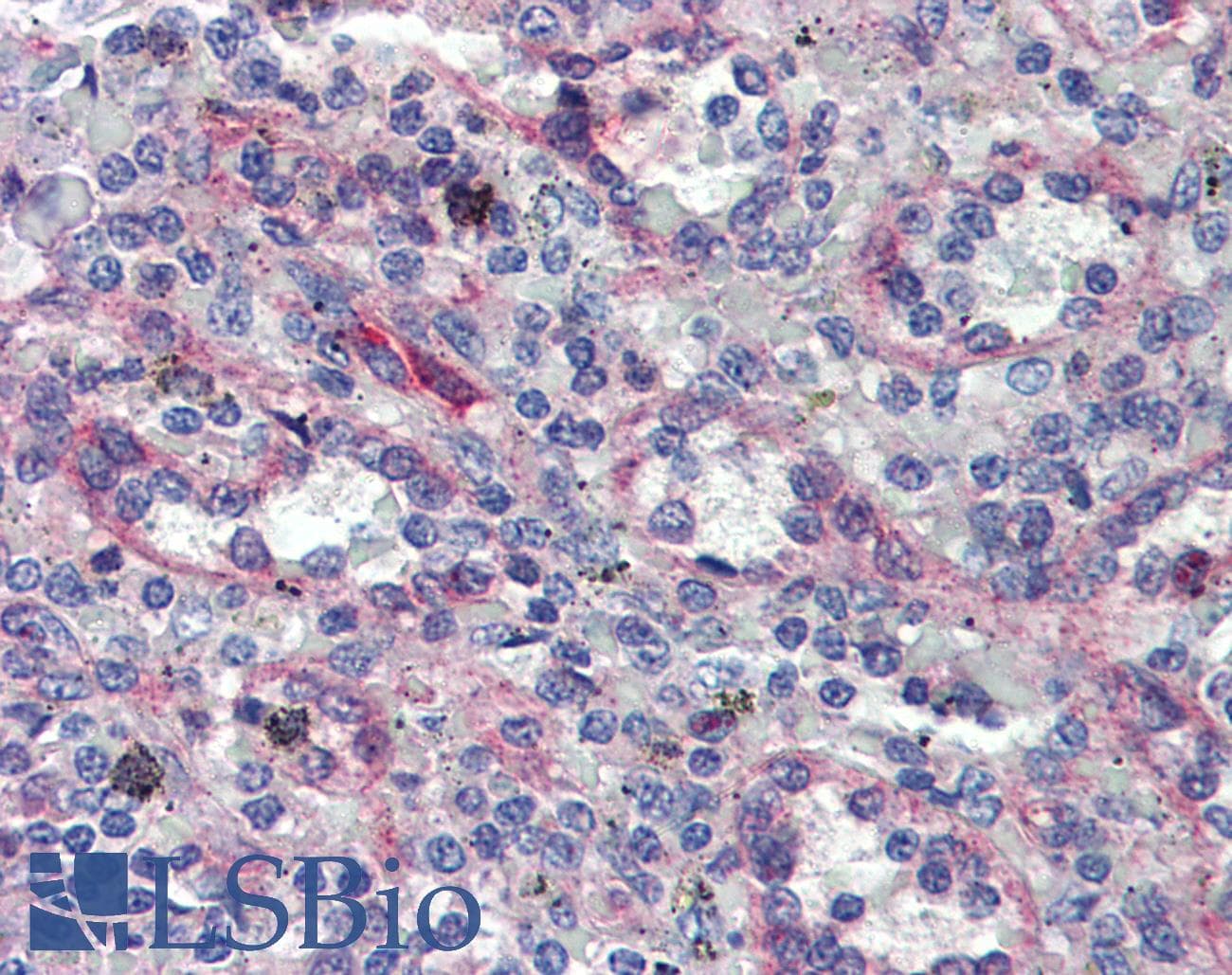 IHC-plus™ ADAM8 Antibody