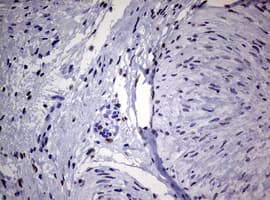 ZEB2 / SIP-1 Antibody (aa1-350, clone OTI1E12)