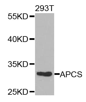 PathPlus™ Polyclonal Rabbit anti-Human APCS / Serum Amyloid P / SAP Antibody (IHC, WB)
