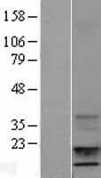 IGF1 Protein (Over-Expression Lysate Myc-DDK (Flag))