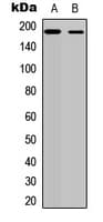 Polyclonal Rabbit anti-Human ERBB4 / HER4 Antibody (C-Terminus, IHC, IF, WB)