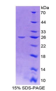Human IGF1R / IGF1 Receptor Protein (Recombinant His-T7)