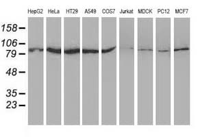 IHC-plus™ SAE2 / UBA2 Antibody (clone 4A3)