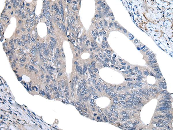 Polyclonal Rabbit anti-Human UBR4 Antibody (IHC)