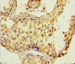 SUPT16H / FACTP140 Antibody