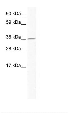 RNF130 Antibody (aa44-93)