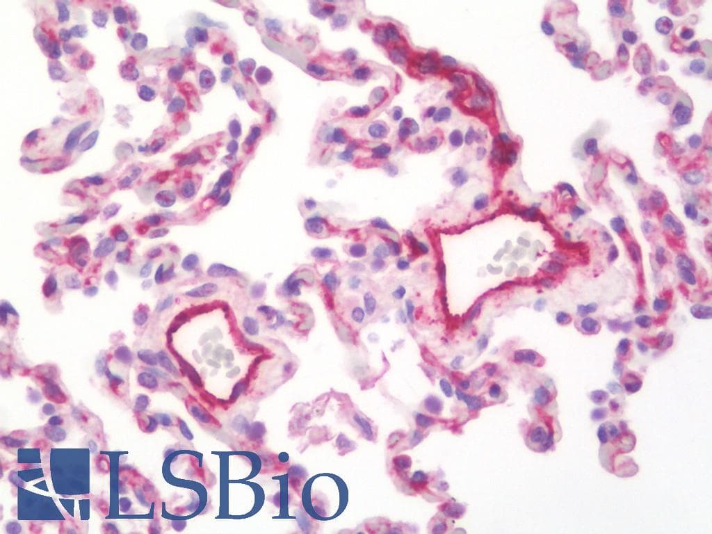 PathPlus™ MCAM / CD146 Antibody (aa84-189, clone 6C3E6)