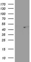 SEC14L2 Antibody (clone OTI1B1)