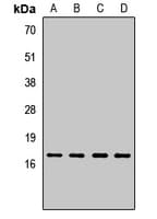 Polyclonal Rabbit anti-Human MAGOH Antibody (WB)