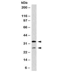 HLA-DP+DQ+DR Antibody (clone CR3/43)