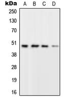 Polyclonal Rabbit anti-Human RPL3 / Ribosomal Protein L3 Antibody (Internal, WB)