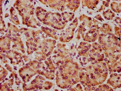 Polyclonal Rabbit anti-Human FRMD7 Antibody (IHC, WB)