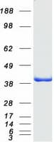 Human CLIC5 Protein (Recombinant Myc-DDK (Flag))
