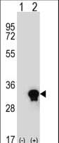 C1QTNF6 / CTRP6 Antibody (aa27-53)