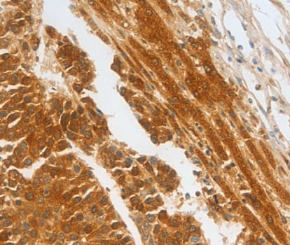 CFHR1 Antibody (aa151-330)