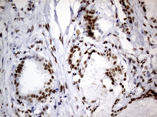 Monoclonal Mouse anti-Human SMC1A / SMC1 Antibody (clone OTI2D12, aa889-1016, IHC, WB)