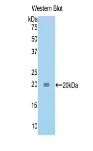 TNC / Tenascin C Antibody (aa175-342, APC)