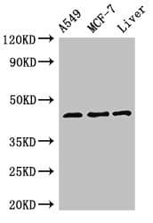 Polyclonal Rabbit anti-Human FMOD / Fibromodulin Antibody (IHC, WB)