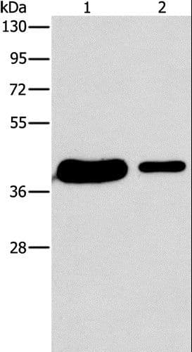 Polyclonal Rabbit anti-Human SAE1 Antibody (IHC, WB)
