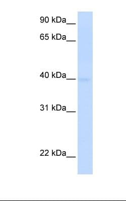 SLC25A36 Antibody (aa36-85, Biotin)