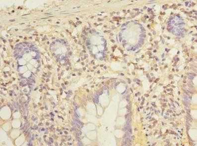 ADGRL4 / ELTD1 Antibody (aa85-299)