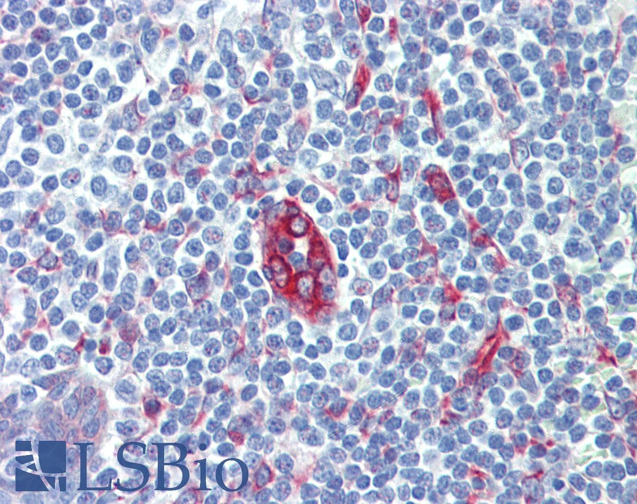 IHC-plus™ SERPINH1 / HSP47 Antibody (clone M16.10A1)