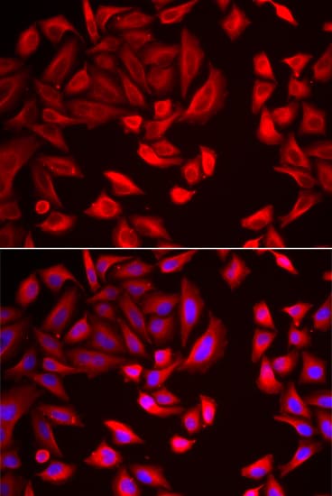 CCT2 / CCT Beta Antibody