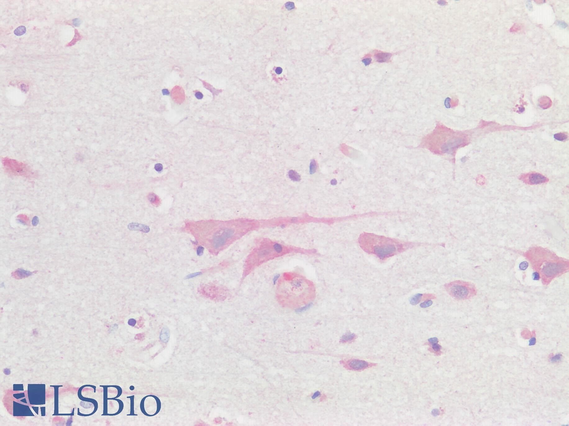 PathPlus™ Polyclonal Rabbit anti-Human BMP6 Antibody (IHC)