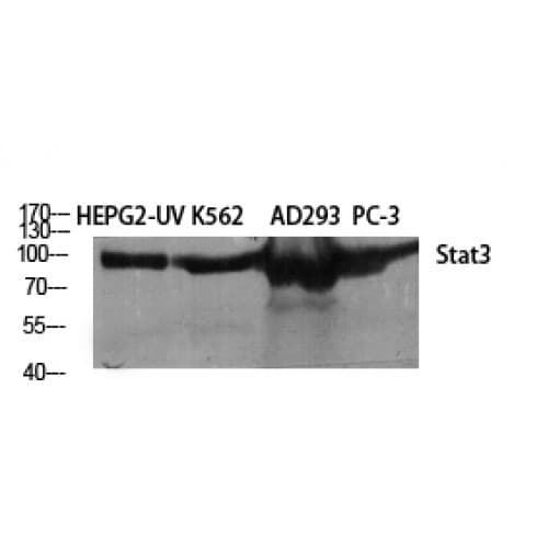 STAT3 Antibody (640-720 aa)