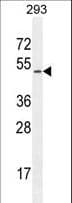 CHRDL1 Antibody (aa2-30)